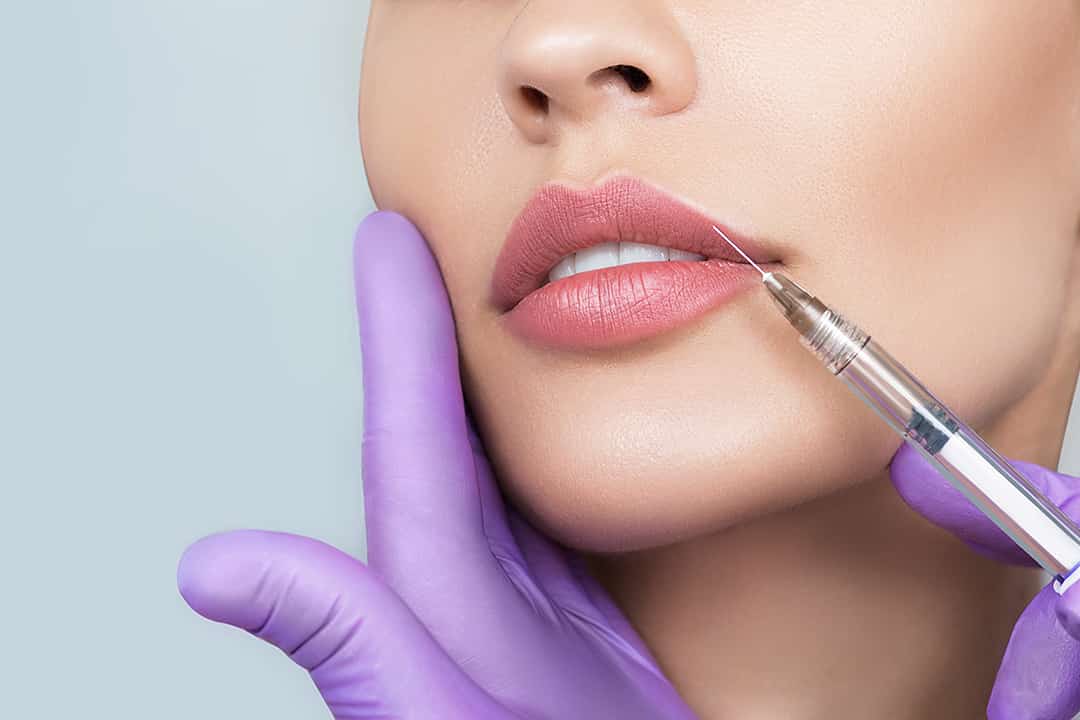 Juveder