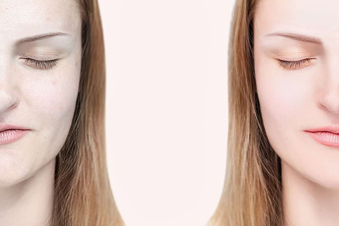 Face